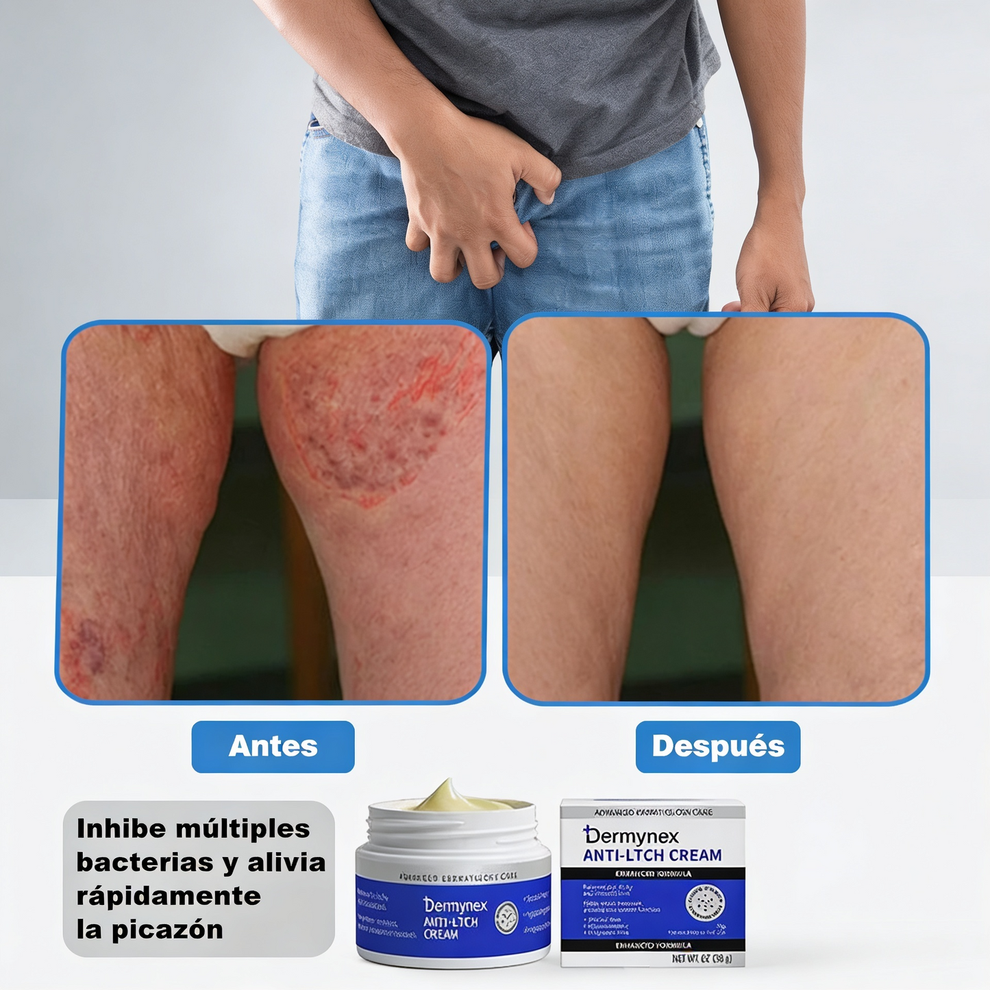 Dermynex — La Crema que Termina con la Picazón íntima Masculina